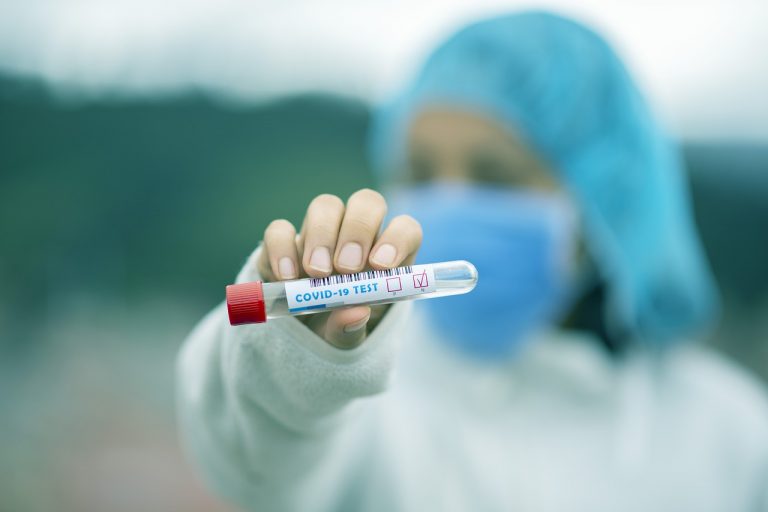 Testy na Covid-19 konieczne przed hospitalizacją