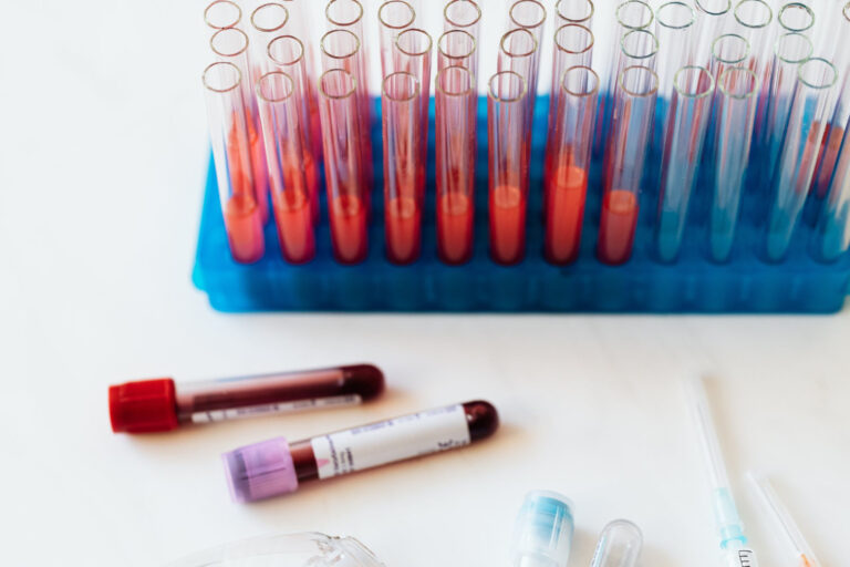 Nieodpłatne testy w kierunku HCV. Zakażenie przez wiele lat bywa bezobjawowe